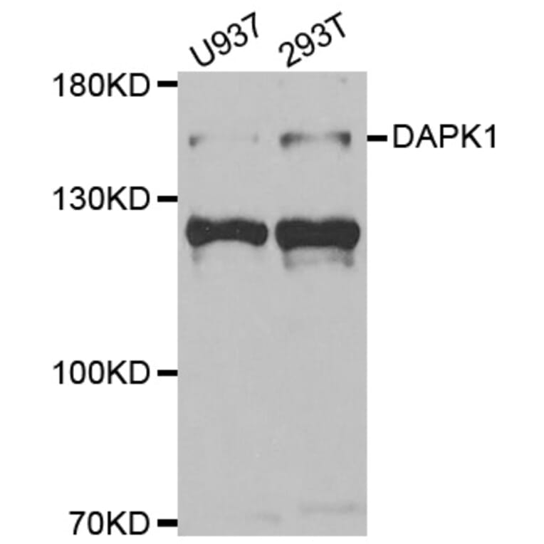 Western blot - DAPK1 Antibody from Signalway Antibody (33007) - Antibodies.com