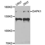 Western blot - DAPK1 Antibody from Signalway Antibody (33007) - Antibodies.com