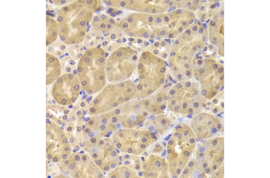 Immunohistochemistry - DAPK1 Antibody from Signalway Antibody (33007) - Antibodies.com