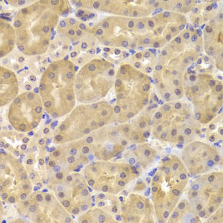 Immunohistochemistry - DAPK1 Antibody from Signalway Antibody (33007) - Antibodies.com