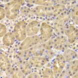 Immunohistochemistry - DAPK1 Antibody from Signalway Antibody (33007) - Antibodies.com