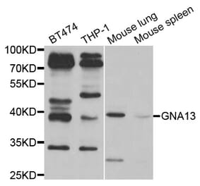 Western blot - GNA13 Antibody from Signalway Antibody (33012) - Antibodies.com