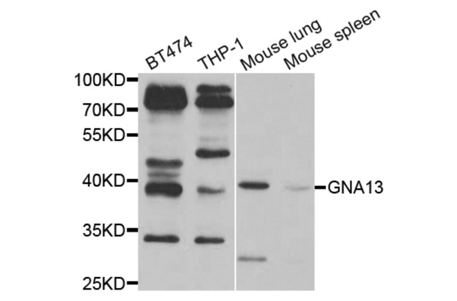 Western blot - GNA13 Antibody from Signalway Antibody (33012) - Antibodies.com