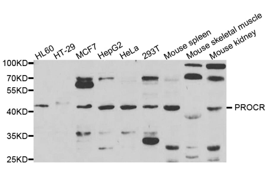 Western blot - PROCR Antibody from Signalway Antibody (33025) - Antibodies.com