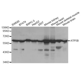Western blot - ATP5B Antibody from Signalway Antibody (33031) - Antibodies.com