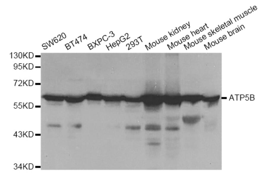 Western blot - ATP5B Antibody from Signalway Antibody (33031) - Antibodies.com