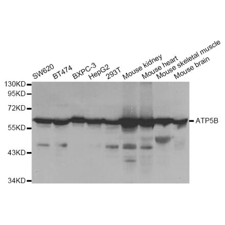 Western blot - ATP5B Antibody from Signalway Antibody (33031) - Antibodies.com