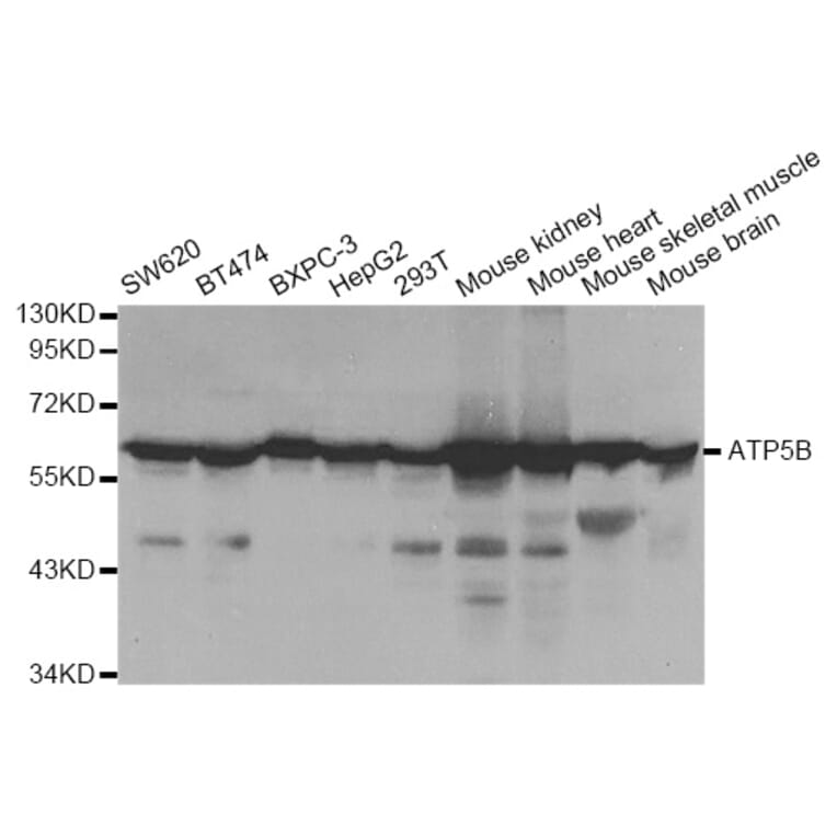 Western blot - ATP5B Antibody from Signalway Antibody (33031) - Antibodies.com