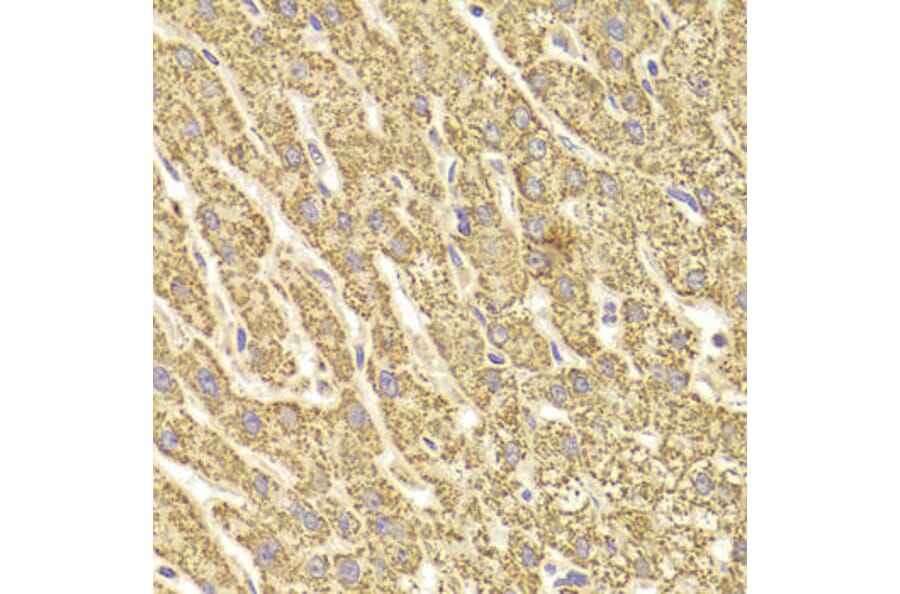 Immunohistochemistry - ATP5B Antibody from Signalway Antibody (33031) - Antibodies.com