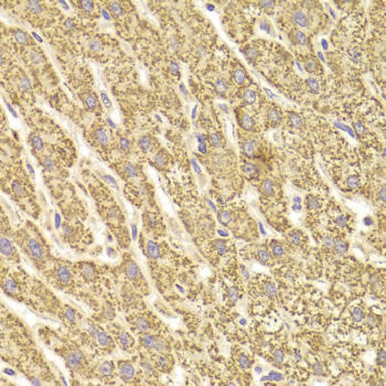 Immunohistochemistry - ATP5B Antibody from Signalway Antibody (33031) - Antibodies.com
