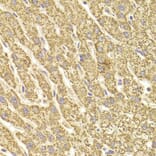Immunohistochemistry - ATP5B Antibody from Signalway Antibody (33031) - Antibodies.com