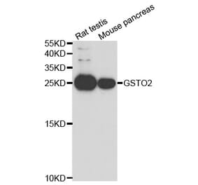 Western blot - GSTO2 Antibody from Signalway Antibody (33036) - Antibodies.com