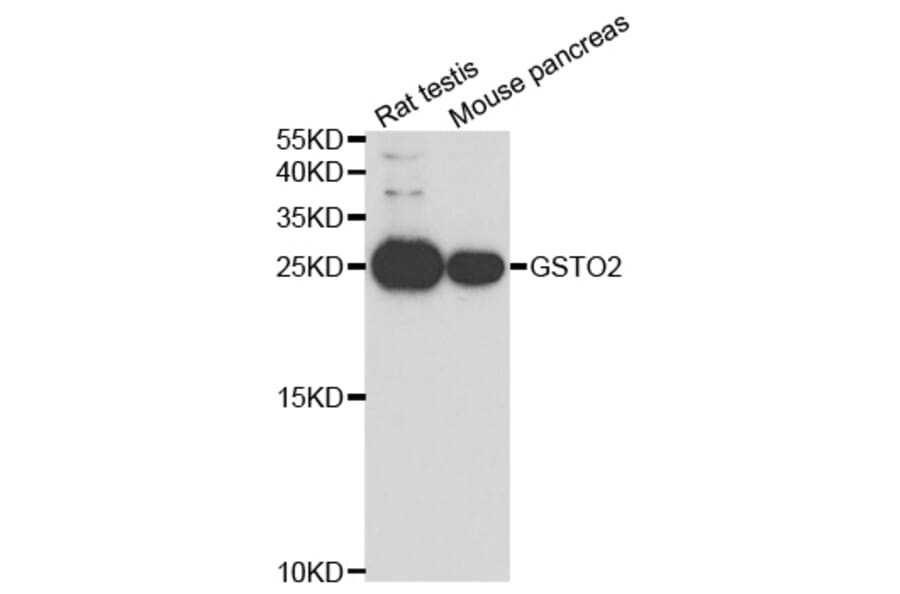 Western blot - GSTO2 Antibody from Signalway Antibody (33036) - Antibodies.com