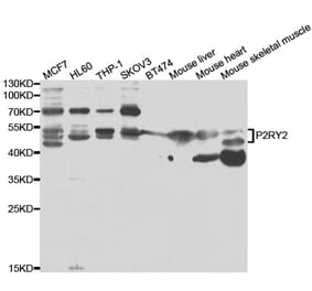 Western blot - P2RY2 Antibody from Signalway Antibody (33041) - Antibodies.com