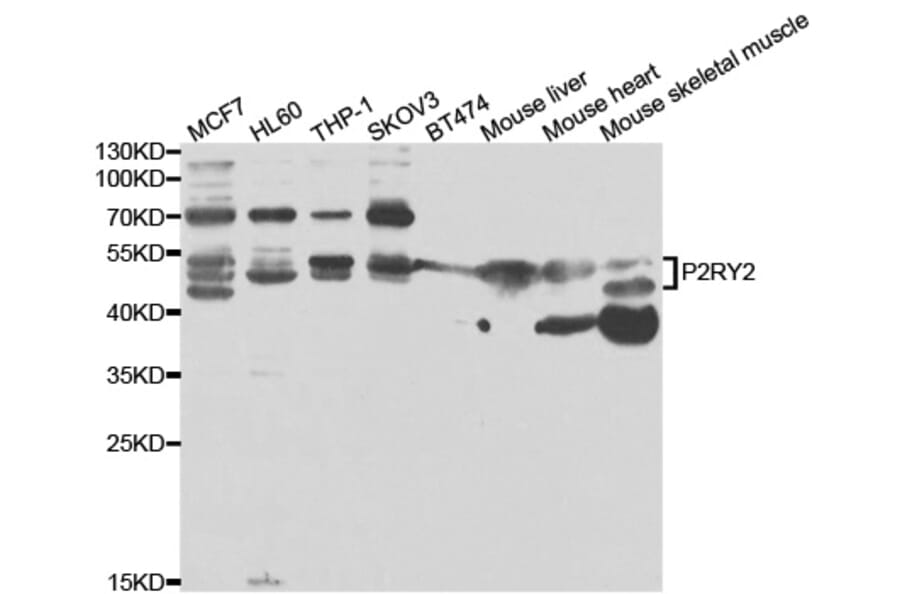 Western blot - P2RY2 Antibody from Signalway Antibody (33041) - Antibodies.com