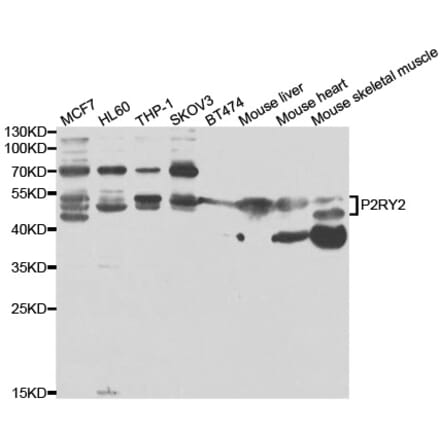 Western blot - P2RY2 Antibody from Signalway Antibody (33041) - Antibodies.com