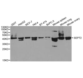 Western blot - SEPT2 Antibody from Signalway Antibody (33053) - Antibodies.com