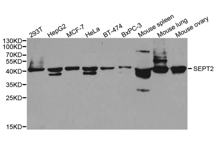 Western blot - SEPT2 Antibody from Signalway Antibody (33053) - Antibodies.com