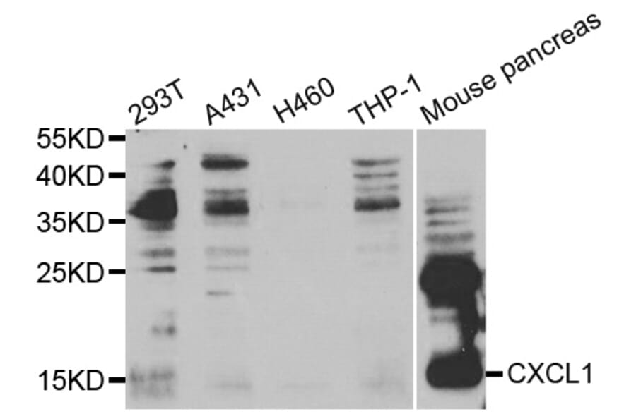Western blot - CXCL1 Antibody from Signalway Antibody (33054) - Antibodies.com