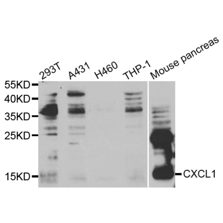 Western blot - CXCL1 Antibody from Signalway Antibody (33054) - Antibodies.com