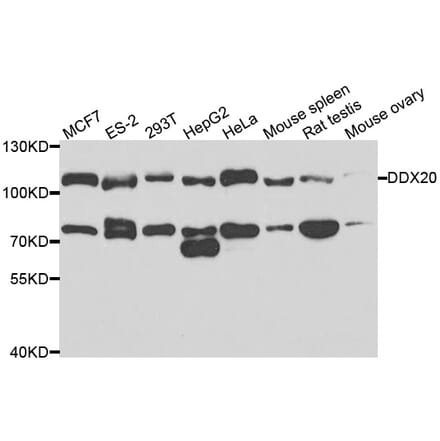 Western blot - DDX20 Antibody from Signalway Antibody (33063) - Antibodies.com