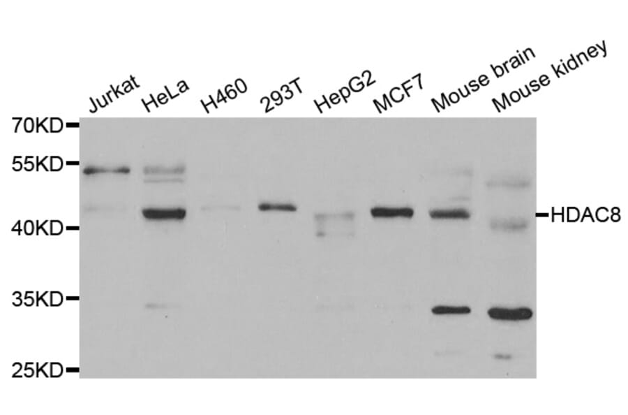 Western blot - HDAC8 Antibody from Signalway Antibody (33072) - Antibodies.com