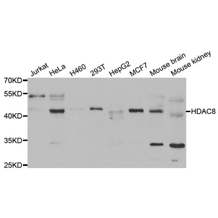 Western blot - HDAC8 Antibody from Signalway Antibody (33072) - Antibodies.com