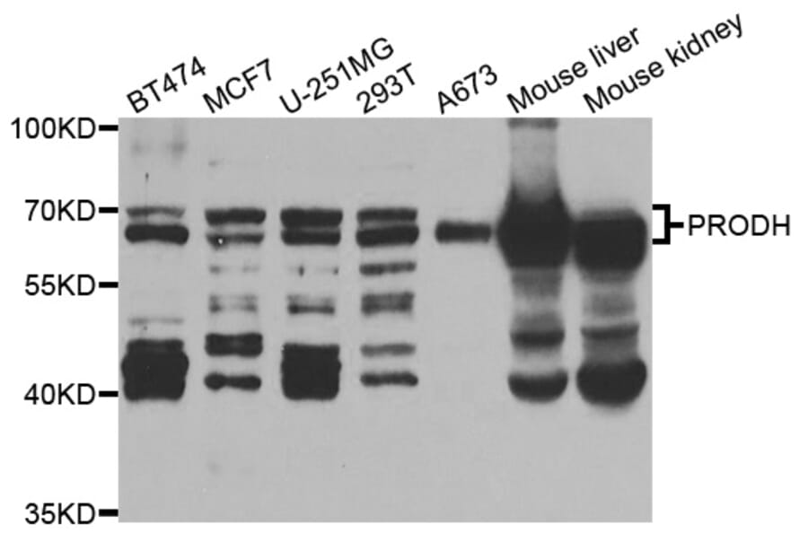 Western blot - PRODH Antibody from Signalway Antibody (33076) - Antibodies.com