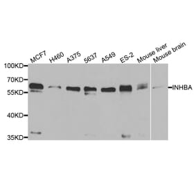 Western blot - INHBA Antibody from Signalway Antibody (33077) - Antibodies.com