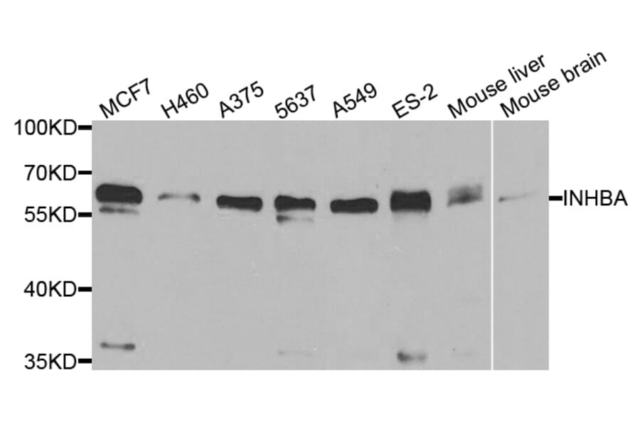 Western blot - INHBA Antibody from Signalway Antibody (33077) - Antibodies.com