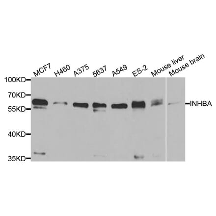 Western blot - INHBA Antibody from Signalway Antibody (33077) - Antibodies.com