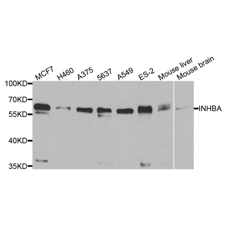 Western blot - INHBA Antibody from Signalway Antibody (33077) - Antibodies.com