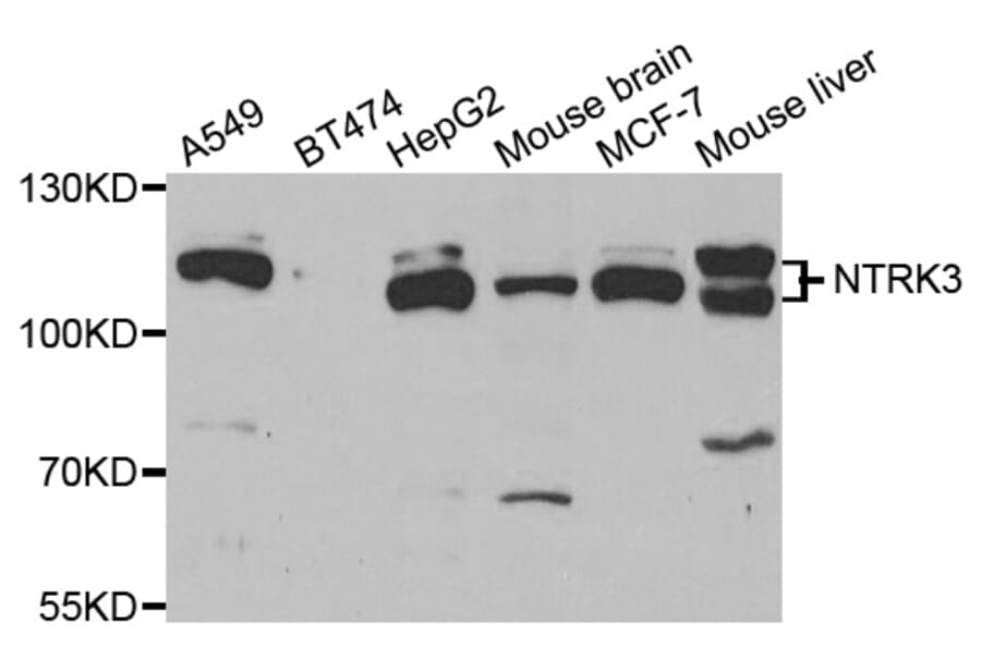 Western blot - NTRK3 Antibody from Signalway Antibody (33081) - Antibodies.com