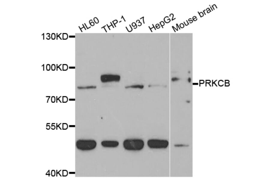 Western blot - PRKCB Antibody from Signalway Antibody (33083) - Antibodies.com