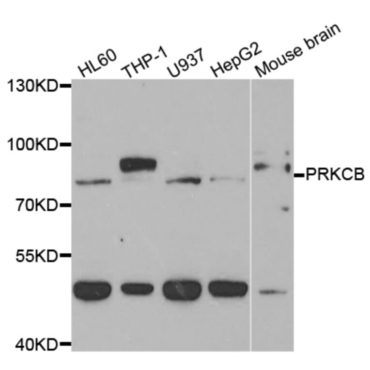 Western blot - PRKCB Antibody from Signalway Antibody (33083) - Antibodies.com