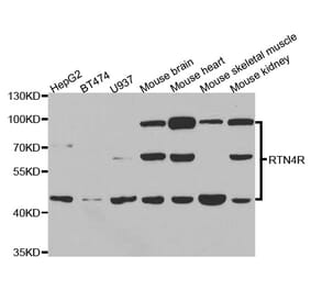 Western blot - RTN4R Antibody from Signalway Antibody (33085) - Antibodies.com