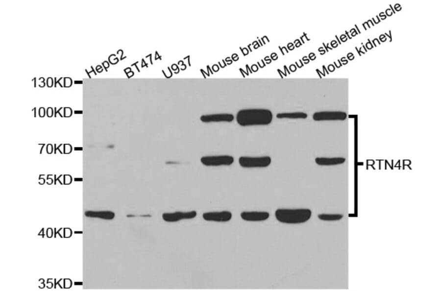 Western blot - RTN4R Antibody from Signalway Antibody (33085) - Antibodies.com