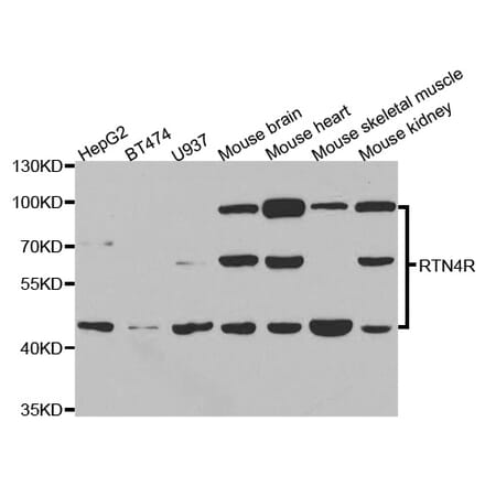 Western blot - RTN4R Antibody from Signalway Antibody (33085) - Antibodies.com
