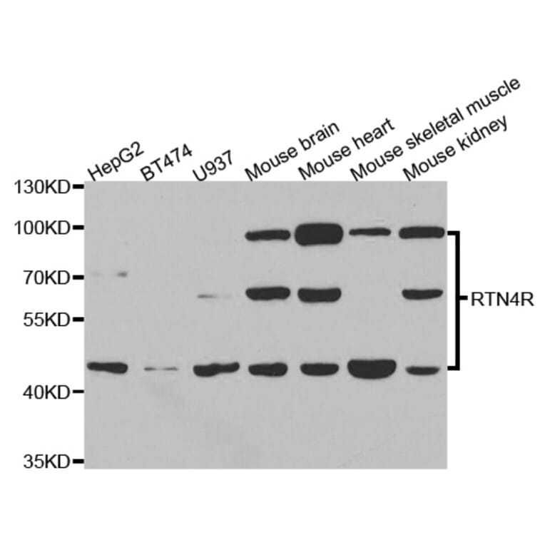 Western blot - RTN4R Antibody from Signalway Antibody (33085) - Antibodies.com