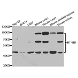 Western blot - RTN4R Antibody from Signalway Antibody (33085) - Antibodies.com