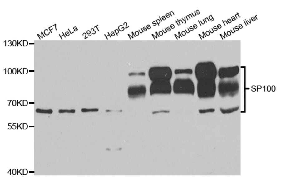 Western blot - SP100 Antibody from Signalway Antibody (33089) - Antibodies.com