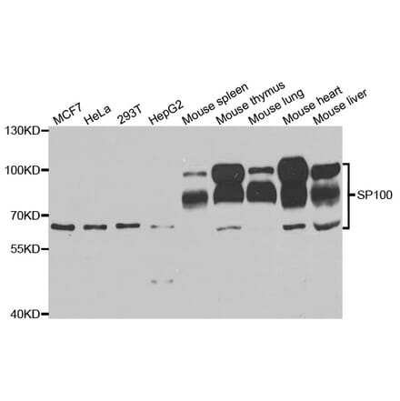 Western blot - SP100 Antibody from Signalway Antibody (33089) - Antibodies.com