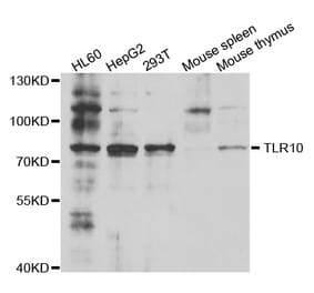 Western blot - TLR10 Antibody from Signalway Antibody (33090) - Antibodies.com