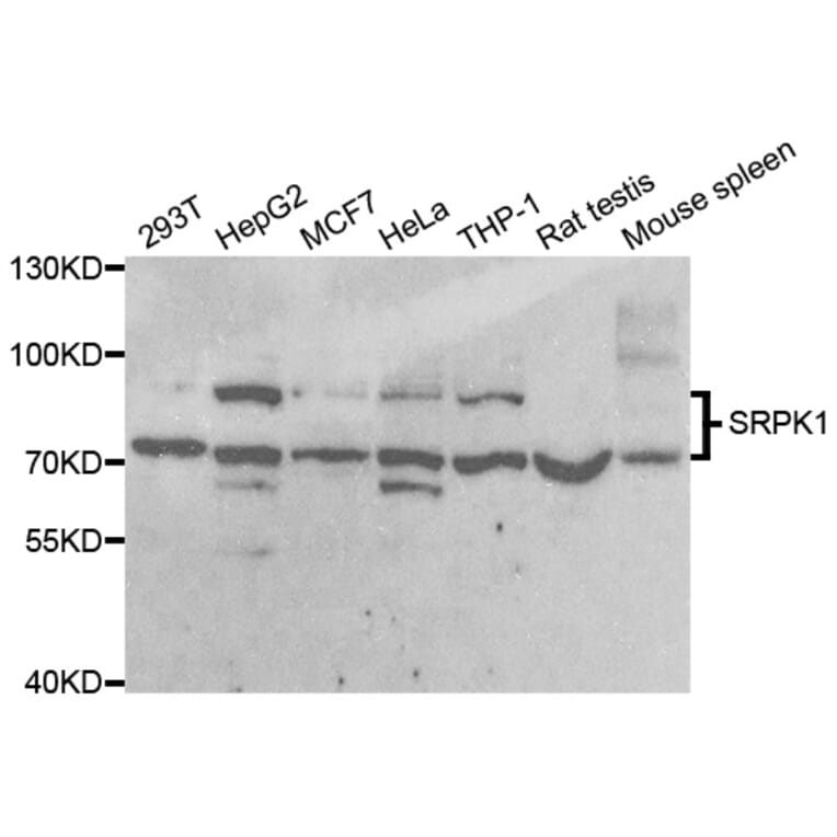 Western blot - SRPK1 Antibody from Signalway Antibody (33092) - Antibodies.com