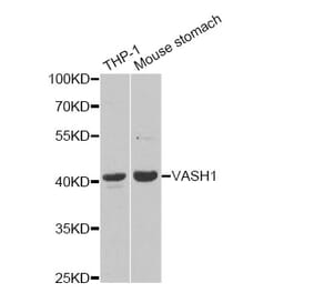 Western blot - VASH1 Antibody from Signalway Antibody (33108) - Antibodies.com