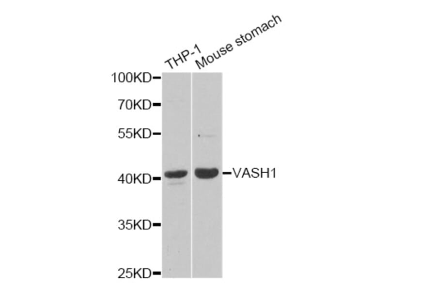 Western blot - VASH1 Antibody from Signalway Antibody (33108) - Antibodies.com