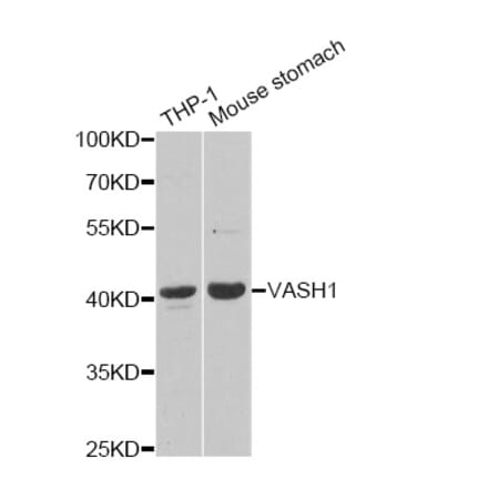 Western blot - VASH1 Antibody from Signalway Antibody (33108) - Antibodies.com