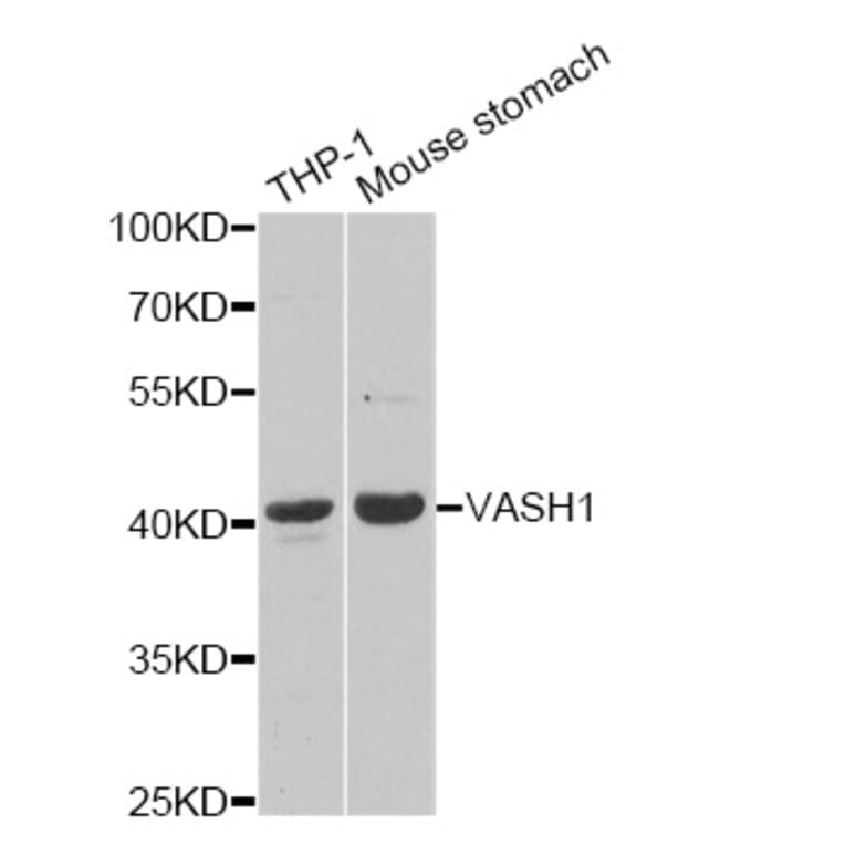 Western blot - VASH1 Antibody from Signalway Antibody (33108) - Antibodies.com