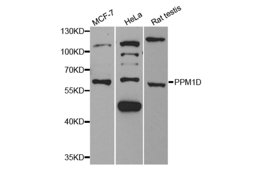 Western blot - PPM1D Antibody from Signalway Antibody (33112) - Antibodies.com