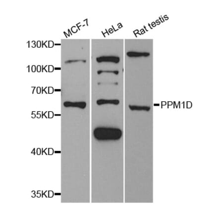 Western blot - PPM1D Antibody from Signalway Antibody (33112) - Antibodies.com